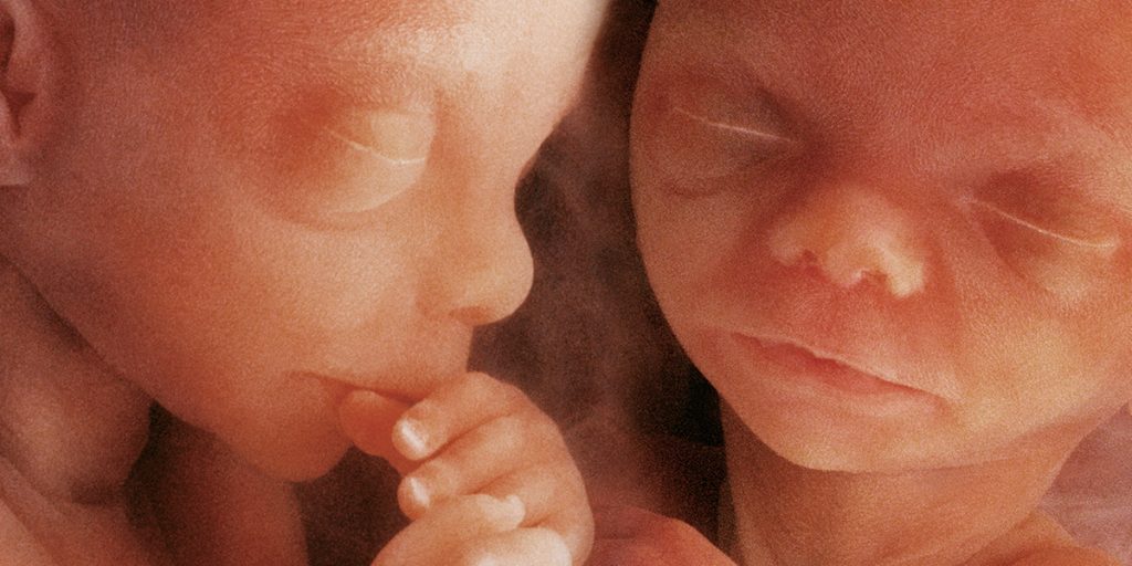 High-Order Multiple Pregnancy Care Gynecology Care KidsHeart Abu Dhabi Alain Dubai