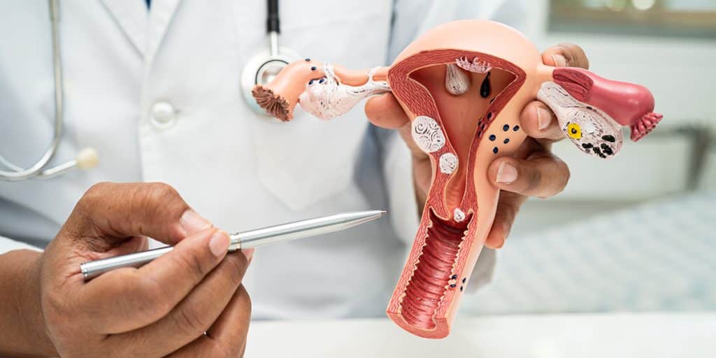 Struggling With PCOS or Hormonal Imbalance Gynecology Care KidsHeart Abu Dhabi Alain Dubai