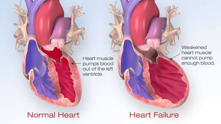 Normal Heart and Heart Failure