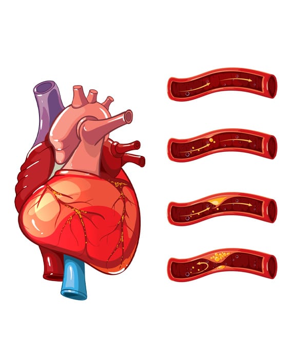 Cardio-Neuro Management​ Adult Cardiology Dubai Al Ain Abu Dhabi