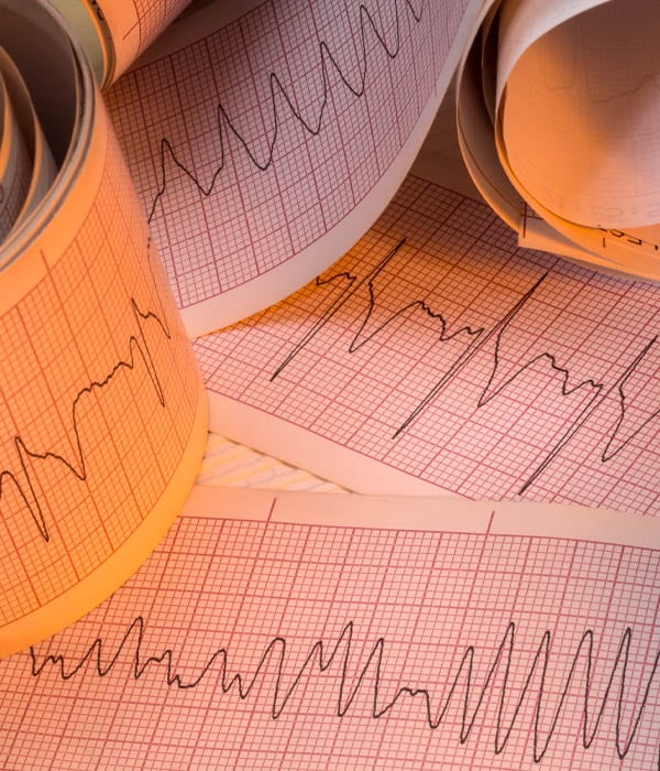 Palpitations & Arrhythmia Workups Adult Cardiology Dubai Al Ain Abu Dhabi