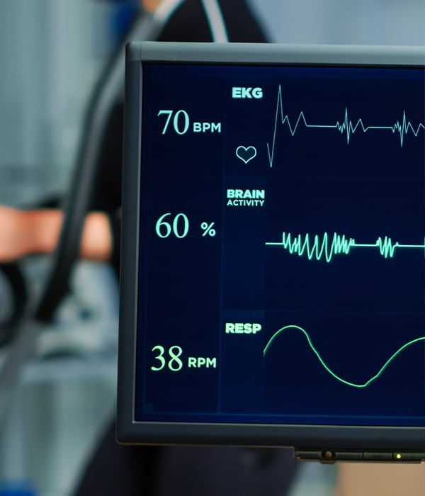 Palpitations & Arrhythmia Workups for​ Adult Cardiology Dubai Al Ain Abu Dhabi