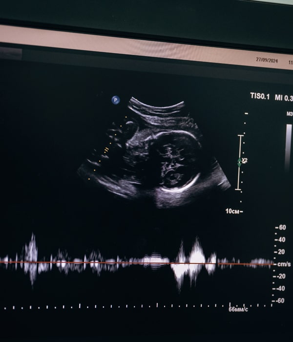 Fetal Echocardiography Obstetrics & Gynecology KidsHeart Dubai Abu Dhabi Alain
