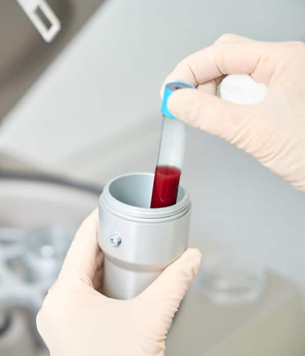 Genetic Carrier Screening Obstetrics & Gynecology KidsHeart Dubai Abu Dhabi Alain