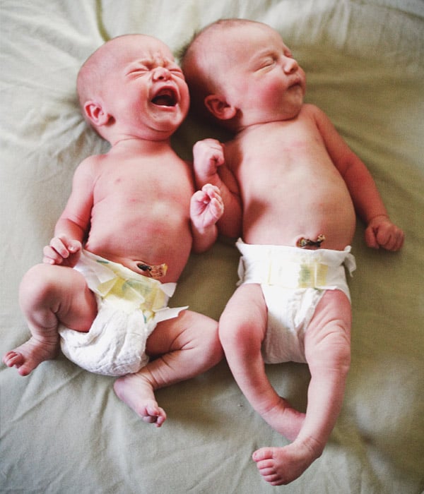 High-Order Multiple Pregnancy Care Obstetrics & Gynecology KidsHeart Dubai Abu Dhabi Alain