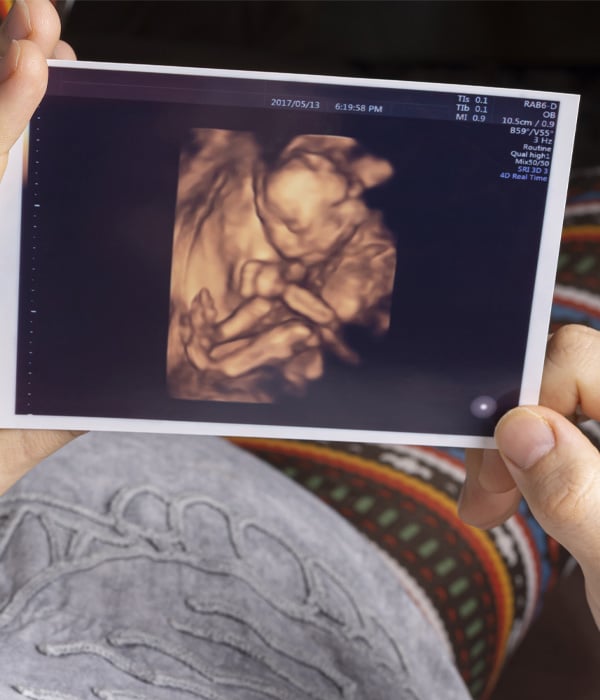 Mid-Trimester Anomaly Scan Obstetrics & Gynecology KidsHeart Dubai Abu Dhabi Alain