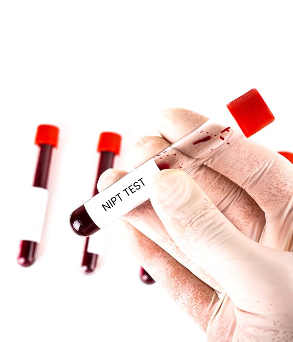 Non-Invasive Prenatal Testing (NIPT) Obstetrics & Gynecology KidsHeart Dubai Abu Dhabi Alain