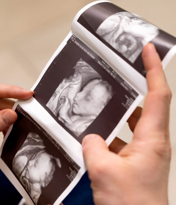 Nuchal Translucency (NT) Combined Test Obstetrics & Gynecology KidsHeart Dubai Abu Dhabi Alain