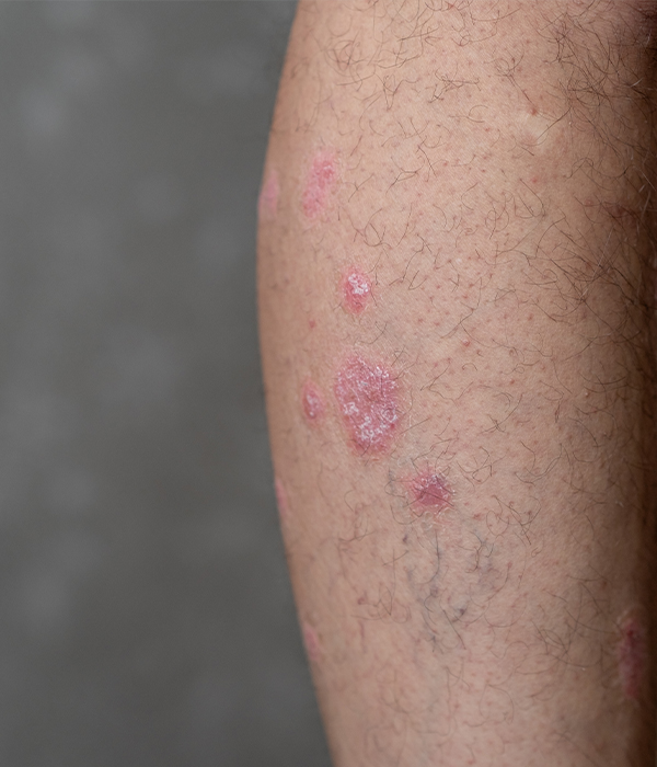 Adult Dermatology Care Dermatology KidsHeart Alain
