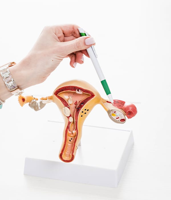 Cervical Cancer Screening (Pap Smear and HPV Testing) Gynecology Care KidsHeart Abu Dhabi Alain Dubai