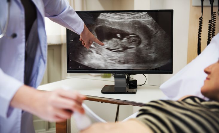 Fetal Echo: Listening to the Baby’s Heartbeat with a Doctor’s Ears