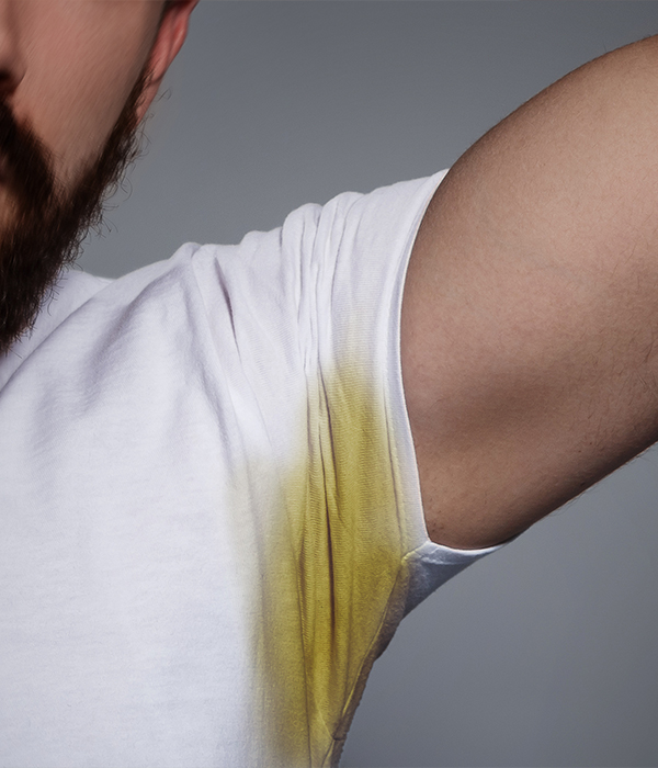 Hyperhidrosis Excessive Sweating Dermatology KidsHeart Alain