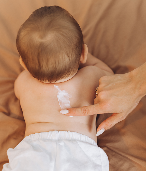 Neonatal Dermatology Consultations Dermatology KidsHeart Alain