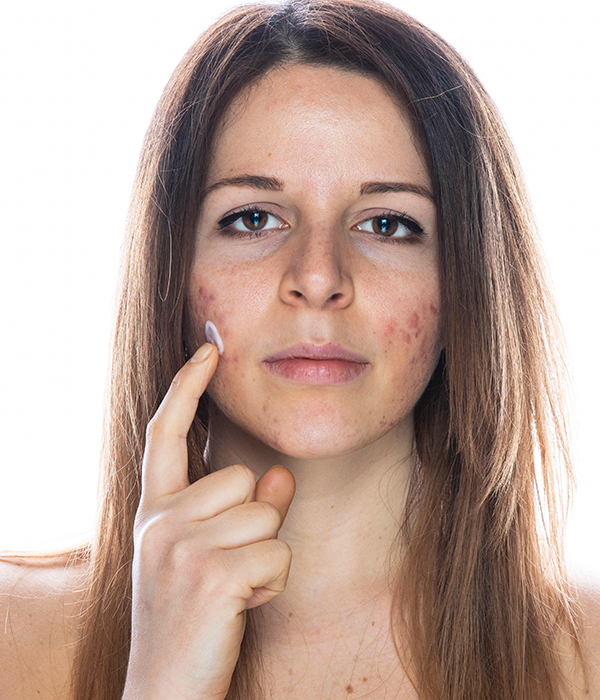 Rosacea and Facial Skin Sensitivity Dermatology KidsHeart Alain