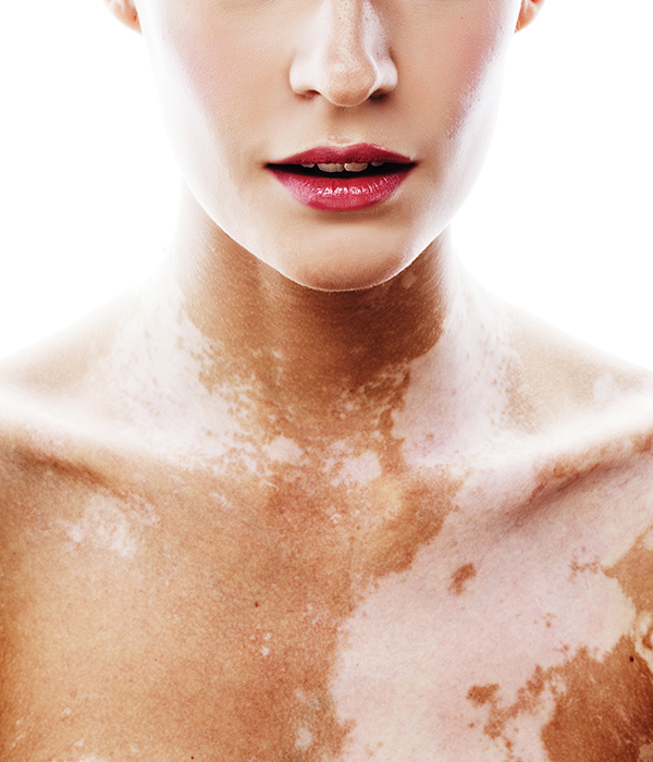 Sun Protection Counselling and Skin Cancer Prevention Dermatology KidsHeart Alain copy