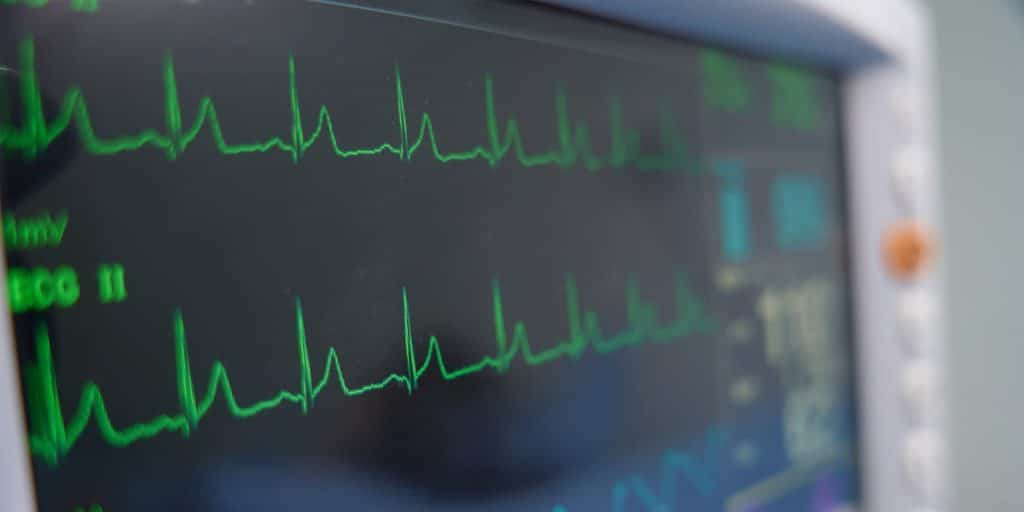 An ECG Can Catch Things That Aren't Yet Causing Symptoms Electrocardiogram (ECG) for Children Cardiography Pediatric Cardiogy KidsHeart Dubai Abu Dhabi Al Ain