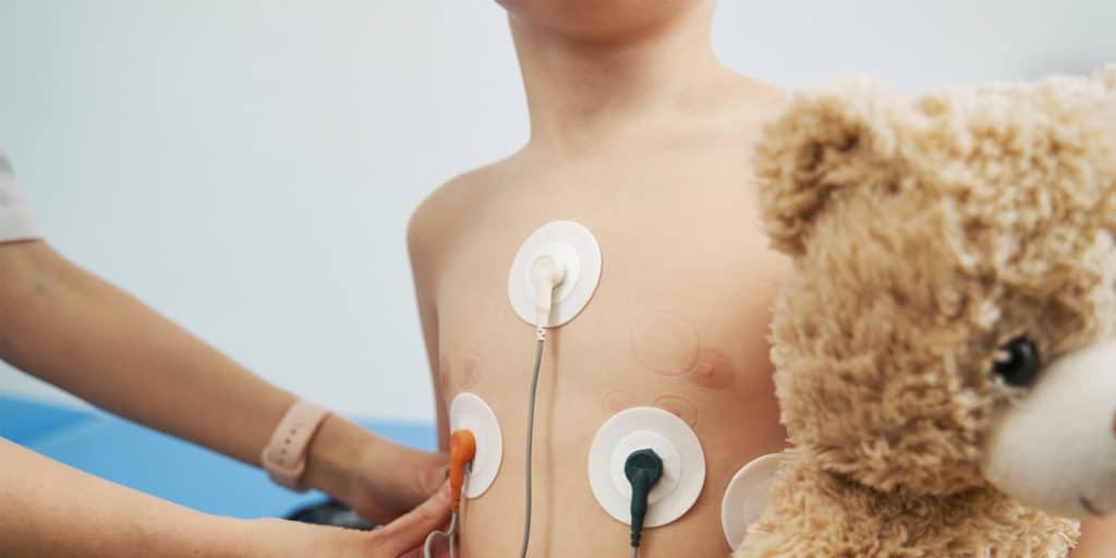 Some Heart Rhythm Problems Only Show Up When You're Not in the Clinic ECG Holter and Cardiac Monitoring for Children for Children Cardiography Pediatric Cardiogy KidsHeart Dubai Abu Dhabi Al Ain