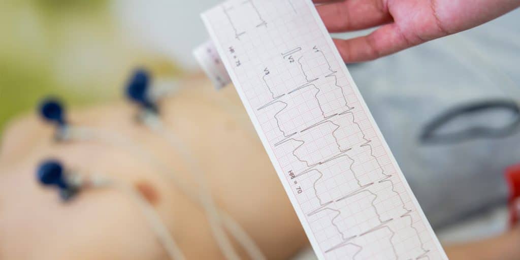 The Test Takes Just 5 to 10 Minutes With No Needles and No Radiation Electrocardiogram (ECG) for Children Cardiography Pediatric Cardiogy KidsHeart Dubai Abu Dhabi Al Ain