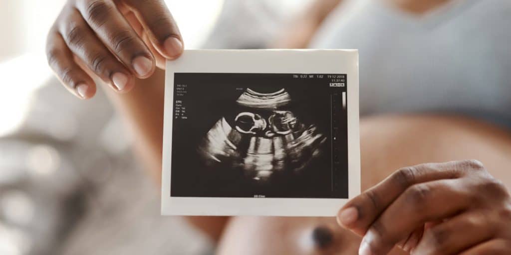 Your Baby's Heart Can Be Checked Before Birth Fetal Echo Cardiography Pediatric Cardiogy KidsHeart Dubai Abu Dhabi Al Ain